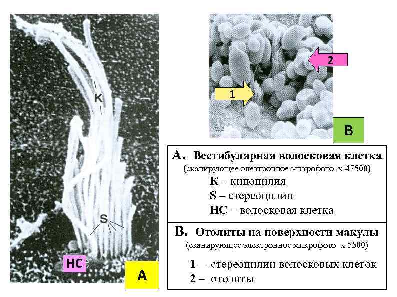 2 1 В А. Вестибулярная волосковая клетка (сканирующее электронное микрофото х 47500) К –