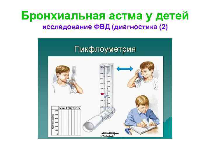 Диагностика бронхиальной астмы картинки