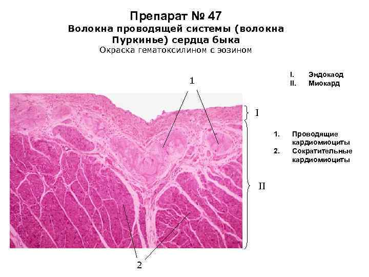 Эндокард рисунок гистология