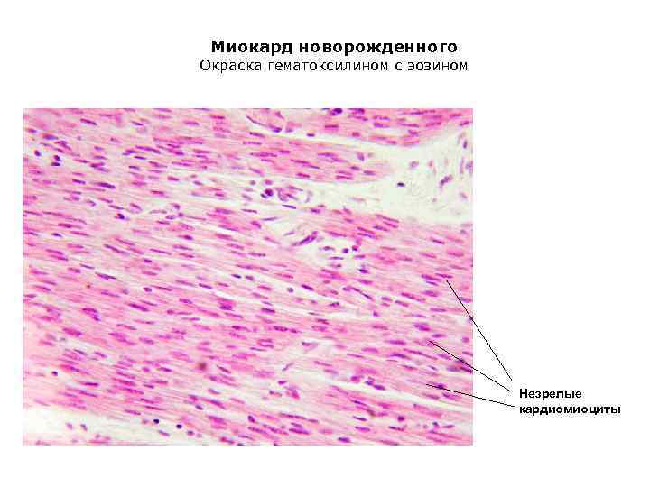 Миокард гистология рисунок