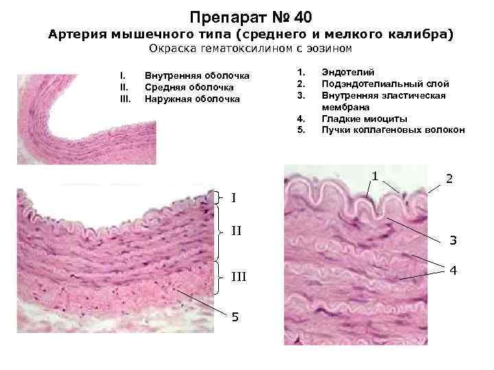 Аорта рисунок гистология