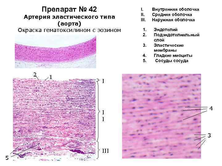 Артерия эластического типа рисунок