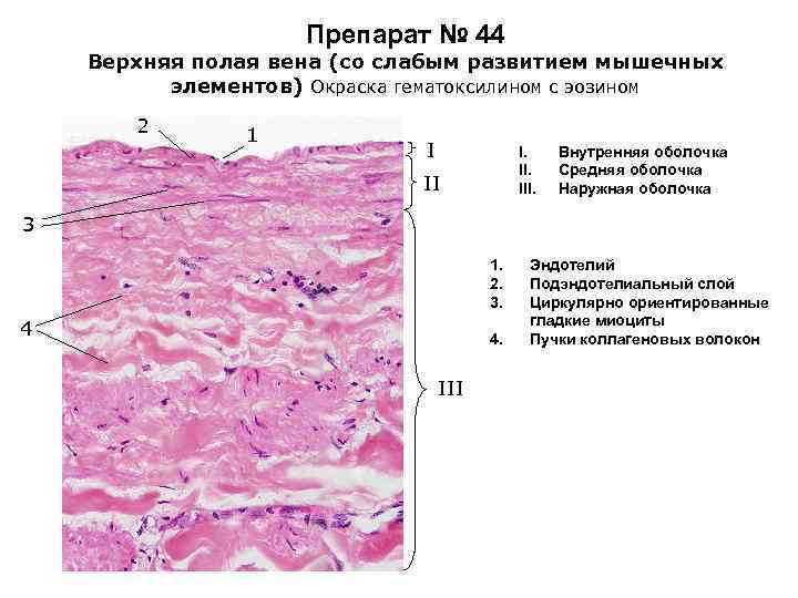 Препарат система