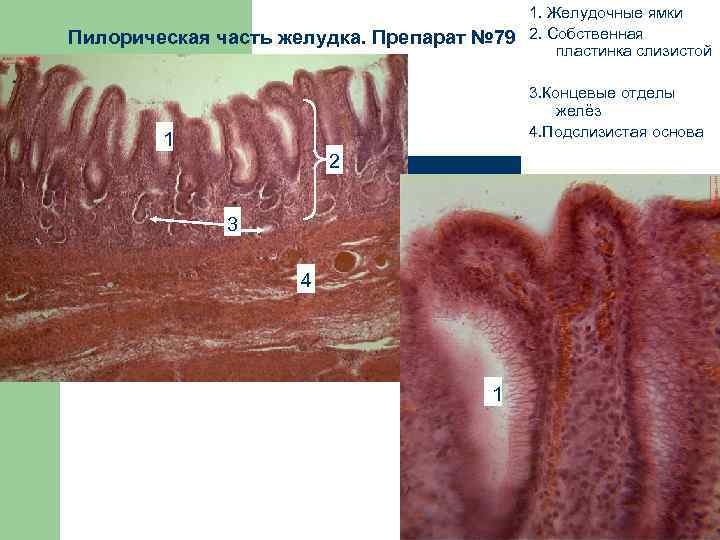 Пилорическая часть желудка. Препарат № 79 1. Желудочные ямки 2. Собственная пластинка слизистой 3.