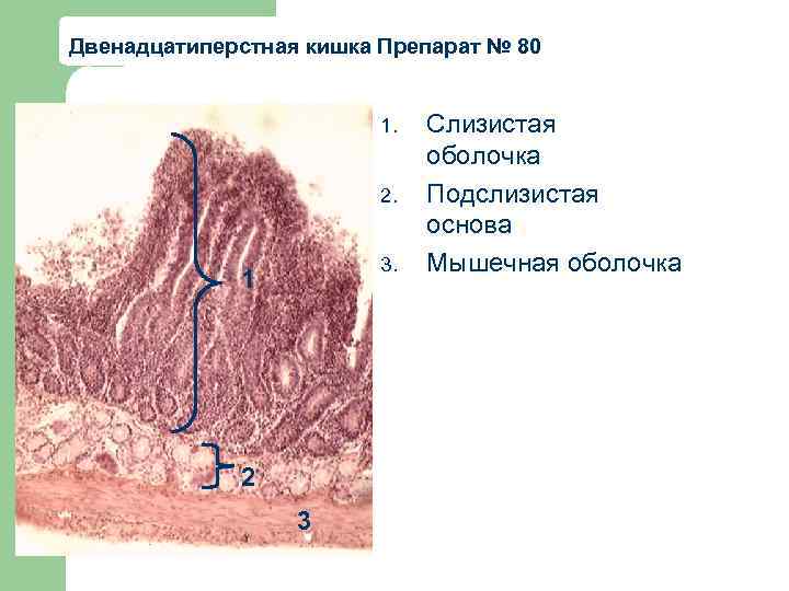 Подслизистая основа какая ткань