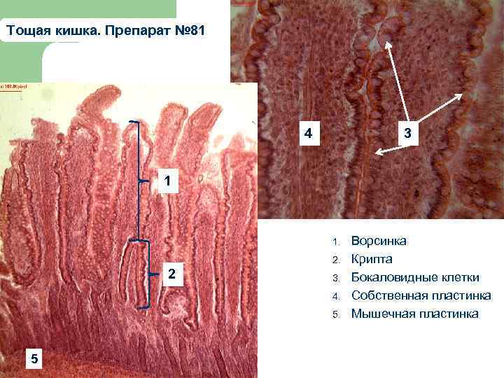 Тощая кишка. Препарат № 81 4 3 1 1. 2. 2 3. 4. 5.