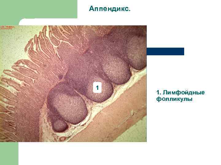Аппендикс. 1 1. Лимфойдные фолликулы 
