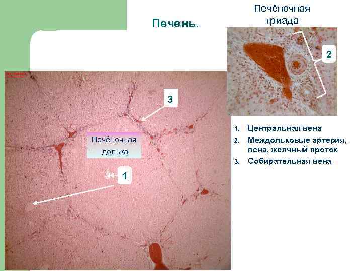 Печёночная триада Печень. 2 3 1. Печёночная долька 2. 3. 1 Центральная вена Междольковые
