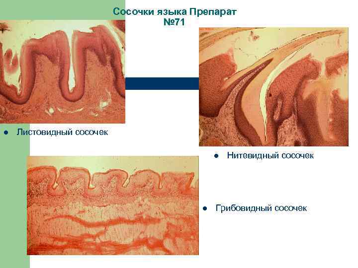 Сосочки языка Препарат № 71 l Листовидный сосочек l l Нитевидный сосочек Грибовидный сосочек