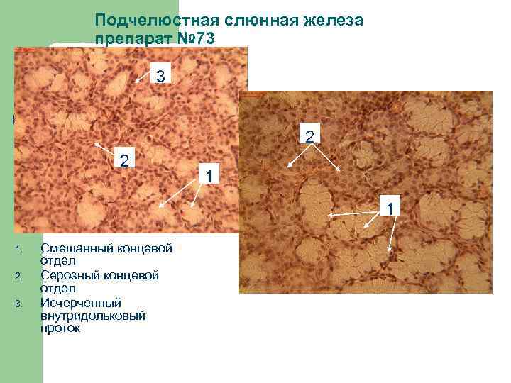 Подчелюстная слюнная железа препарат № 73 3 2 2 1 1 1. 2. 3.