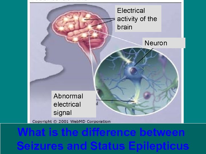 Electrical activity of the brain Neuron Abnormal electrical signal What is the difference between