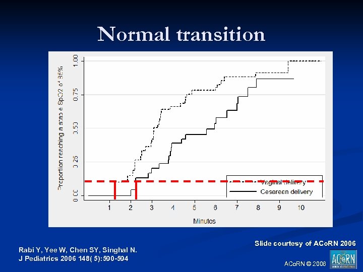 Normal transition Rabi Y, Yee W, Chen SY, Singhal N. J Pediatrics 2006 148(