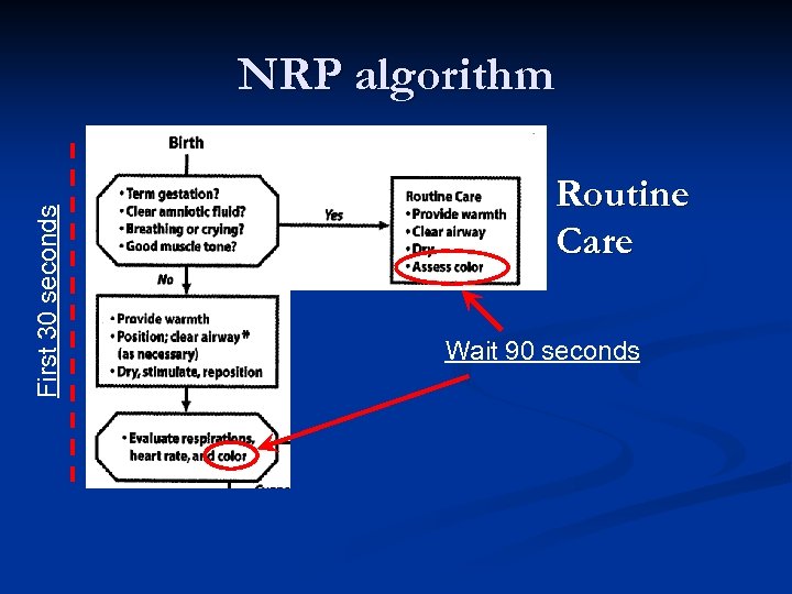 First 30 seconds NRP algorithm Routine Care Wait 90 seconds 