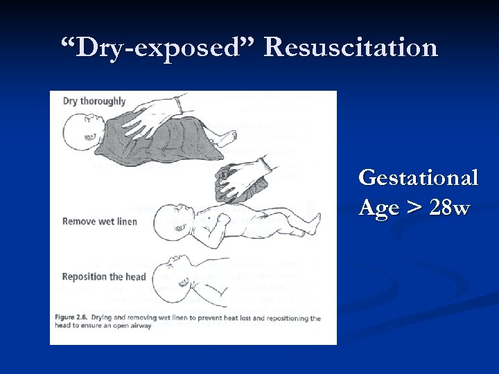 “Dry-exposed” Resuscitation Gestational Age > 28 w 