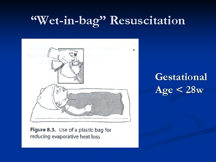 “Wet-in-bag” Resuscitation Gestational Age < 28 w 