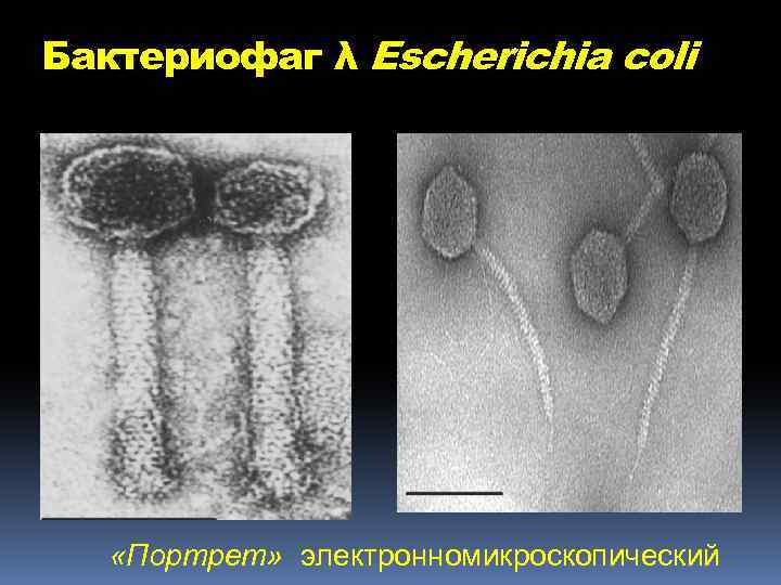 Бактериофаг λ Escherichia coli «Портрет» электронномикроскопический 