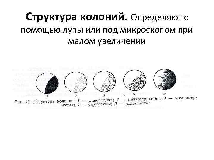 Структура колоний. Определяют с помощью лупы или под микроскопом при малом увеличении 