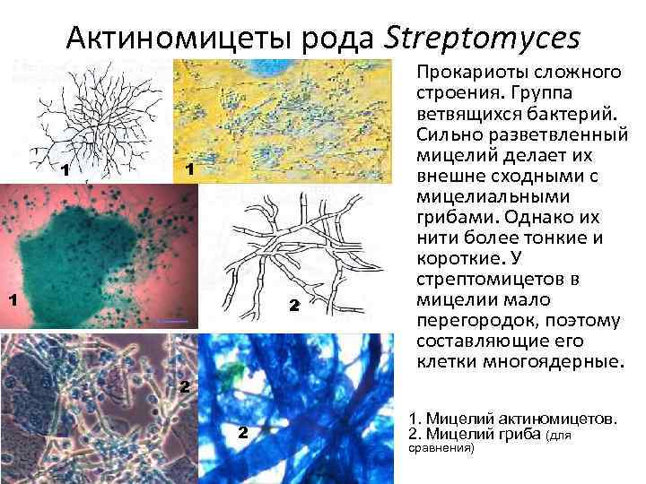 Актиномицеты рода Streptomyces 1 1 1 2 Прокариоты сложного строения. Группа ветвящихся бактерий. Сильно