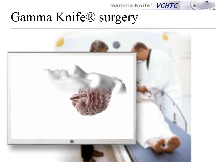 Gamma Knife® surgery 