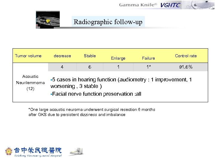 Radiographic follow-up Tumor volume Stable 4 Acoustic Neurilemmoma (12) decrease 6 Enlarge Failure 1