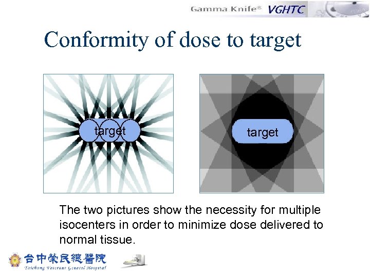 Conformity of dose to target The two pictures show the necessity for multiple isocenters