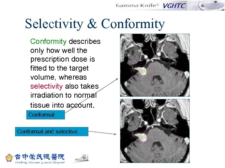 Selectivity & Conformity describes only how well the prescription dose is fitted to the