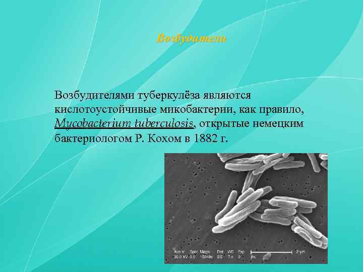 Возбудители Возбудителями туберкулёза являются кислотоустойчивые микобактерии, как правило, Mycobacterium tuberculosis, открытые немецким бактериологом Р.