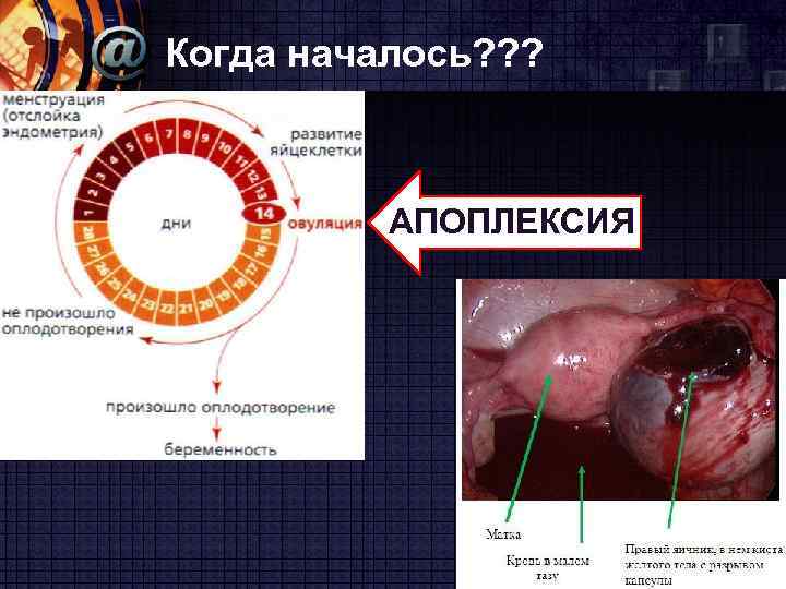 Когда началось? ? ? АПОПЛЕКСИЯ www. themegallery. com LOGO 