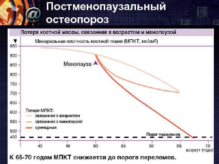 Постменопаузальный остеопороз презентация