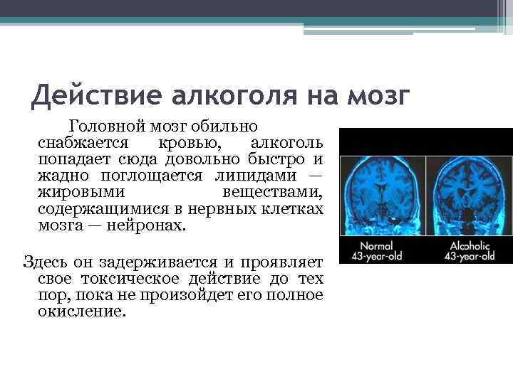 Действие алкоголя на мозг Головной мозг обильно снабжается кровью, алкоголь попадает сюда довольно быстро