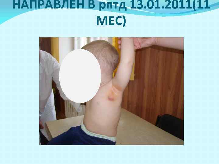 НАПРАВЛЕН В рптд 13. 01. 2011(11 МЕС) 