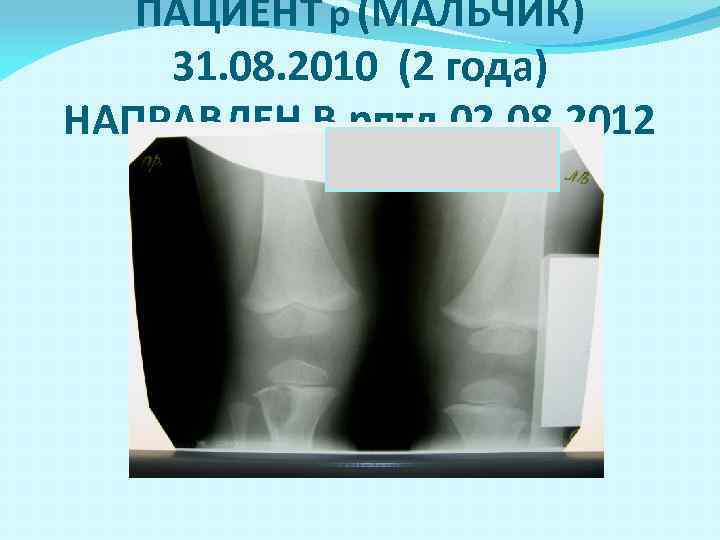 ПАЦИЕНТ р (МАЛЬЧИК) 31. 08. 2010 (2 года) НАПРАВЛЕН В рптд 02. 08. 2012