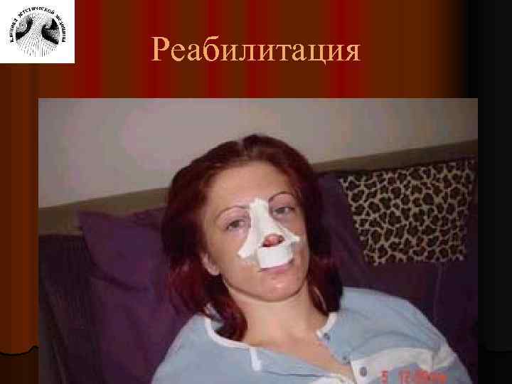 Реабилитация 