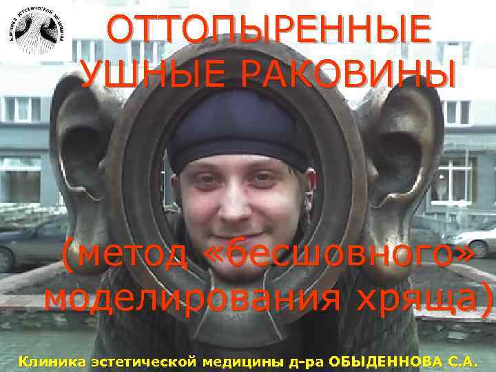 ОТТОПЫРЕННЫЕ УШНЫЕ РАКОВИНЫ (метод «бесшовного» моделирования хряща) Клиника эстетической медицины д-ра ОБЫДЕННОВА C. А.