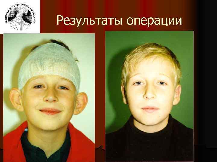 Результаты операции 