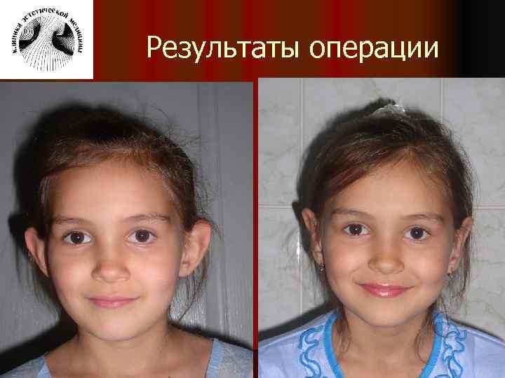 Результаты операции 