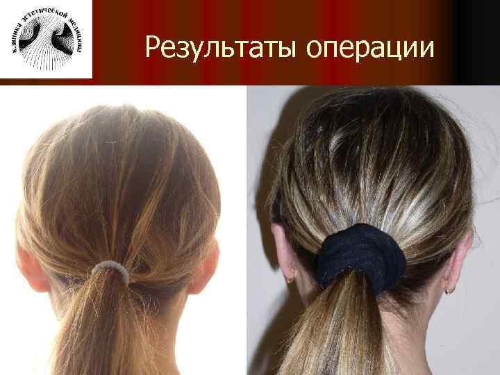 Результаты операции 