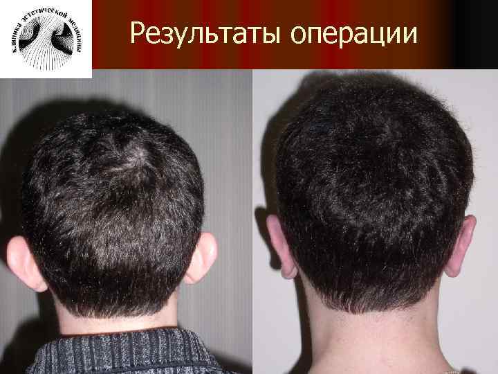 Результаты операции 