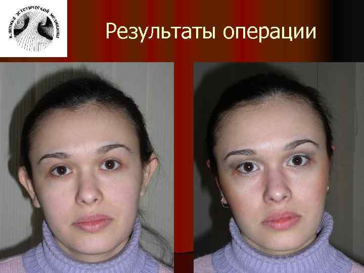 Результаты операции 