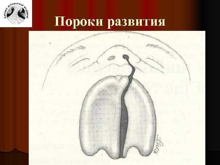 Пороки развития 