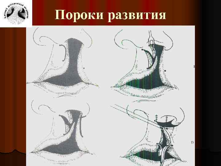 Пороки развития 