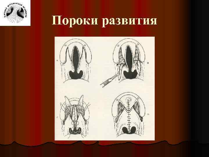 Пороки развития 