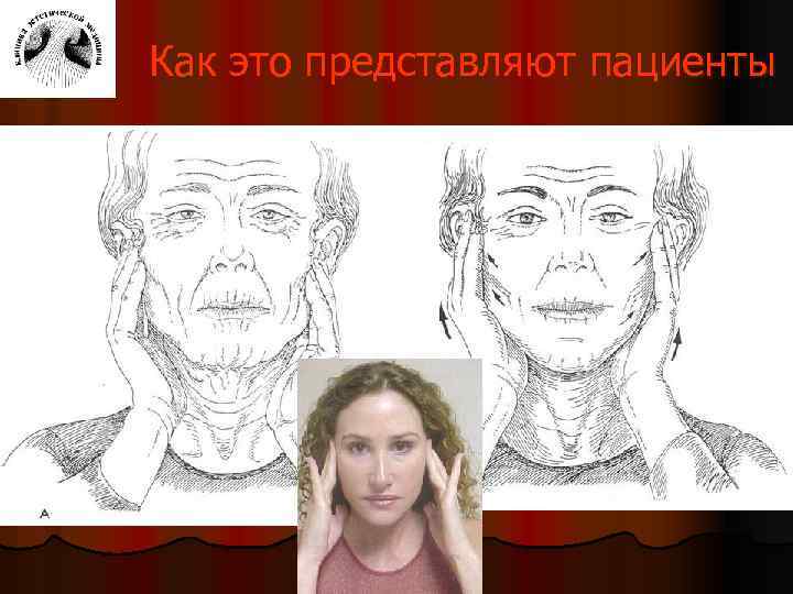 Как это представляют пациенты 