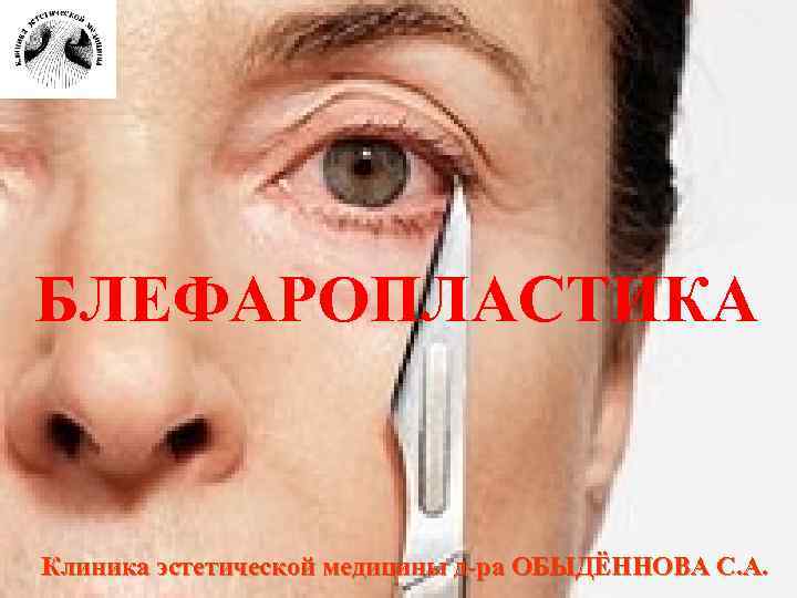 БЛЕФАРОПЛАСТИКА Клиника эстетической медицины д-ра ОБЫДЁННОВА С. А. 