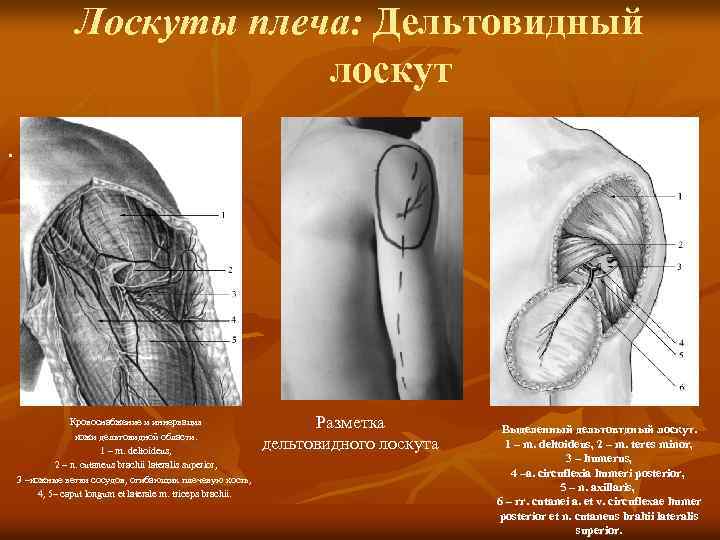 Лоскуты плеча: Дельтовидный лоскут. Кровоснабжение и иннервация кожи дельтовидной области. 1 – m. deltoideus,