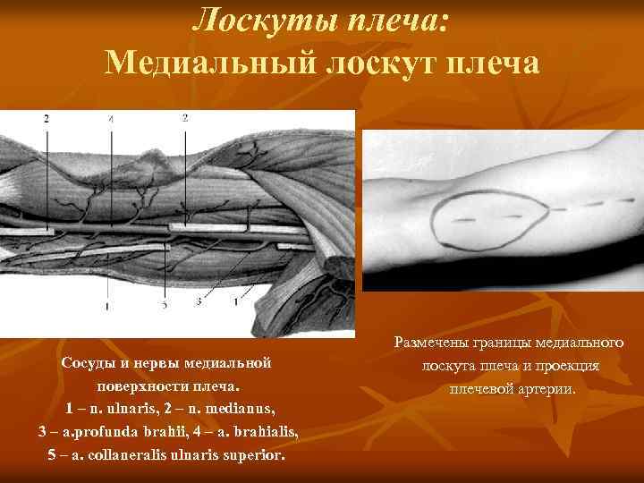 Лоскуты плеча: Медиальный лоскут плеча Сосуды и нервы медиальной поверхности плеча. 1 – n.