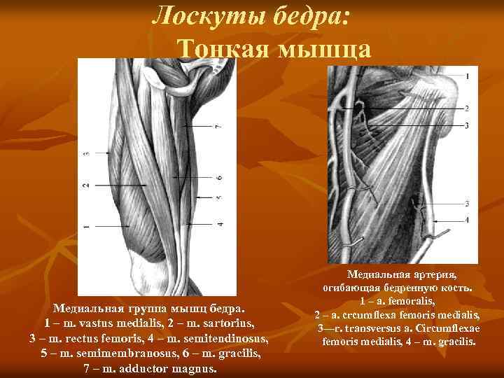 Лоскуты бедра: Тонкая мышца Медиальная группа мышц бедра. 1 – m. vastus medialis, 2