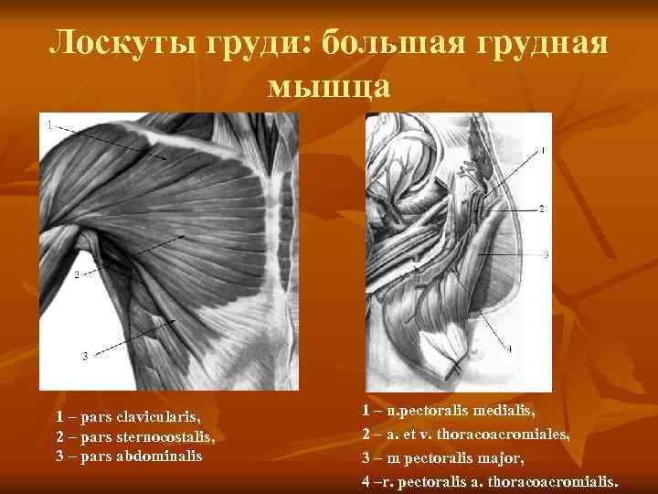 Лоскуты груди: большая грудная мышца 1 – pars clavicularis, 2 – pars sternocostalis, 3