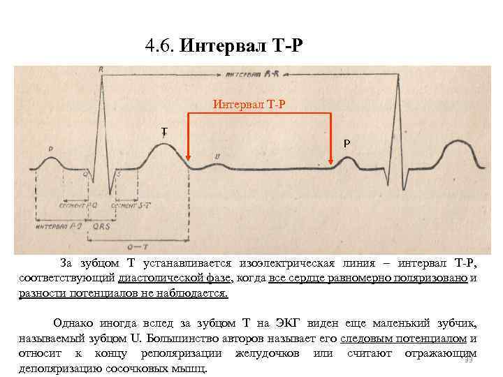 4. 6. Интервал Т-P Интервал Т P За зубцом Т устанавливается изоэлектрическая линия –