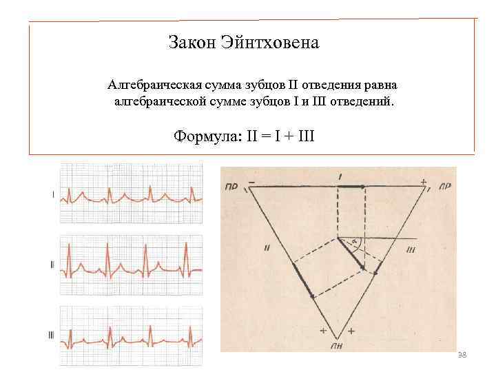  Закон Эйнтховена Алгебраическая сумма зубцов II отведения равна алгебраической сумме зубцов I и